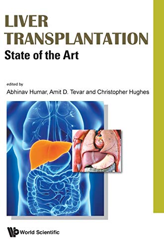 Algopix Similar Product 19 - Liver Transplantation: State of the Art