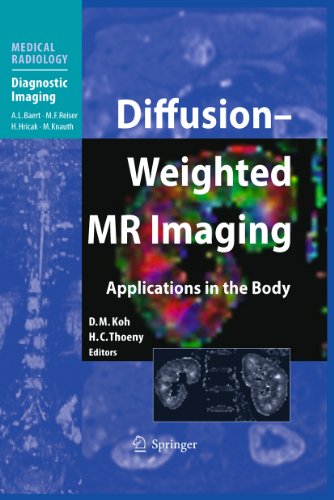 Algopix Similar Product 16 - DiffusionWeighted MR Imaging