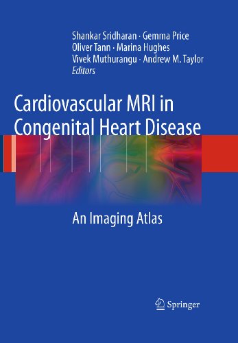 Algopix Similar Product 9 - Cardiovascular MRI in Congenital Heart
