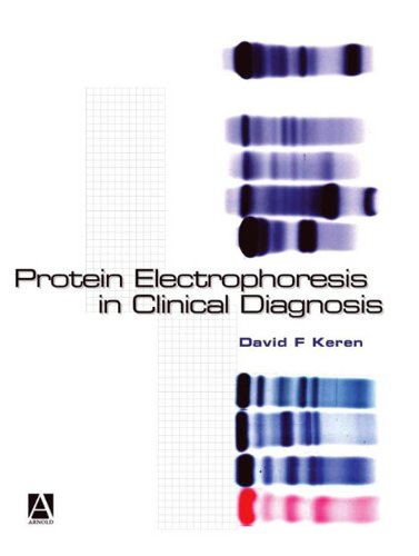 Algopix Similar Product 6 - Protein Electrophoresis in Clinical