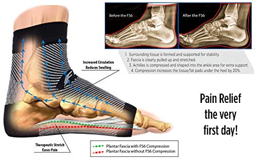 Algopix Similar Product 13 - OrthoSleeve FS6 Compression Foot Sleeve