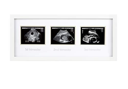 Algopix Similar Product 7 - Pearhead Sonogram Progression Frame 