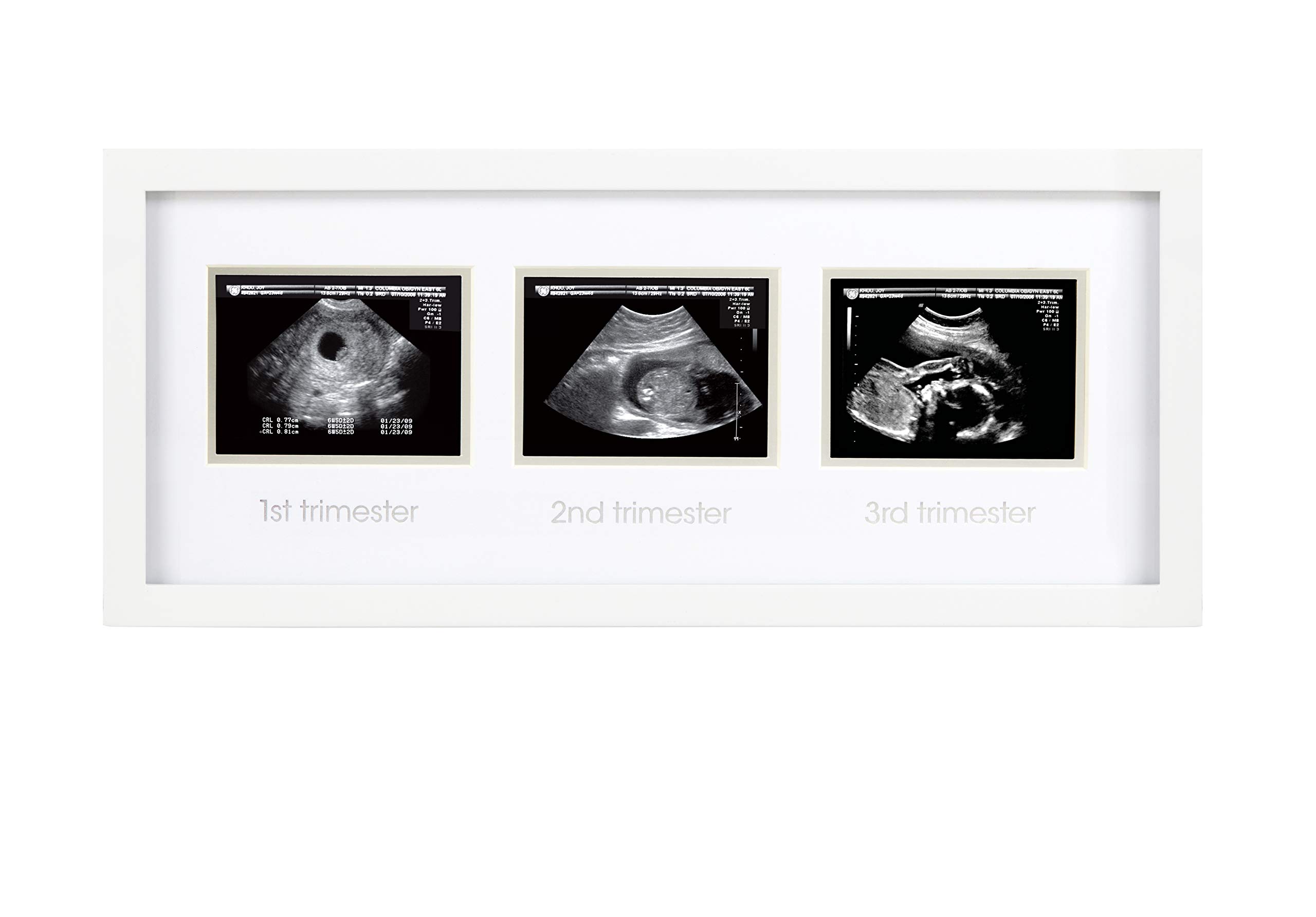 Algopix Similar Product 17 - Pearhead Sonogram Progression Frame