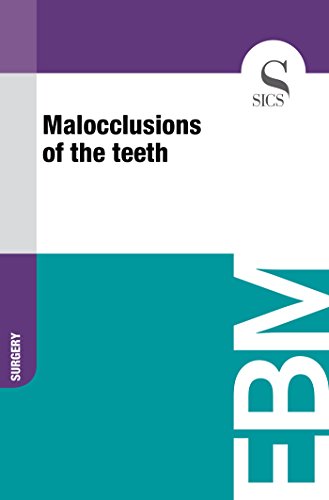 Algopix Similar Product 5 - Malocclusions of the Teeth