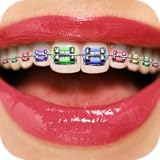 Algopix Similar Product 14 - Teeth Braces Booth - Funny Face Filters