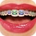 Algopix Similar Product 1 - Teeth Braces Booth - Funny Face Filters