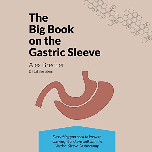 Algopix Similar Product 2 - The BIG Book on the Gastric Sleeve