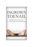 Algopix Similar Product 15 - Foot Pain Ingrown Toenail How To