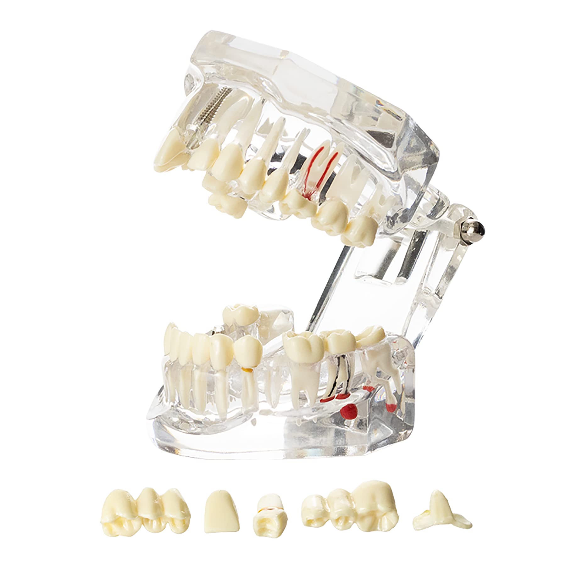 Algopix Similar Product 9 - Dentalmall Dental Oral Typodont Model