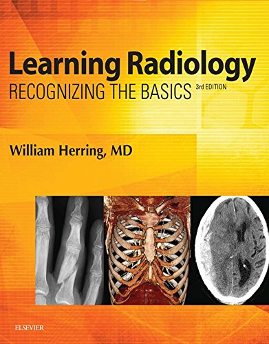Algopix Similar Product 12 - Learning Radiology EBook Recognizing