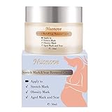 Algopix Similar Product 1 - Stretch Mark Cream for Pregnancy