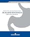 Algopix Similar Product 2 - ACALASIA ESOFAGEA CRITICITA E