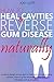 Algopix Similar Product 1 - How to Heal Cavities and Reverse Gum