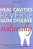 Algopix Similar Product 18 - How to Heal Cavities and Reverse Gum