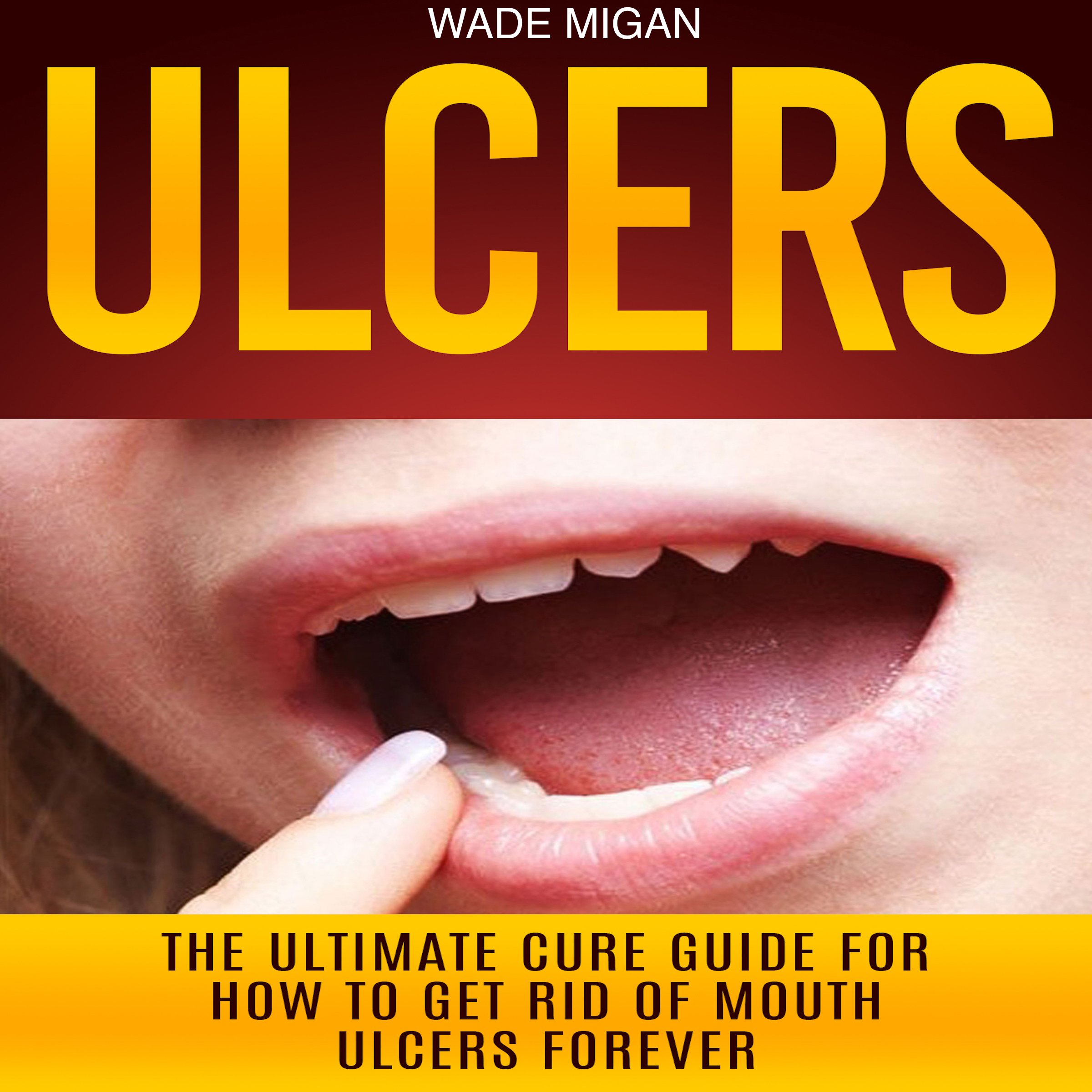 Algopix Similar Product 16 - Ulcers The Ultimate Cure Guide for How