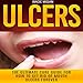 Algopix Similar Product 12 - Ulcers The Ultimate Cure Guide for How