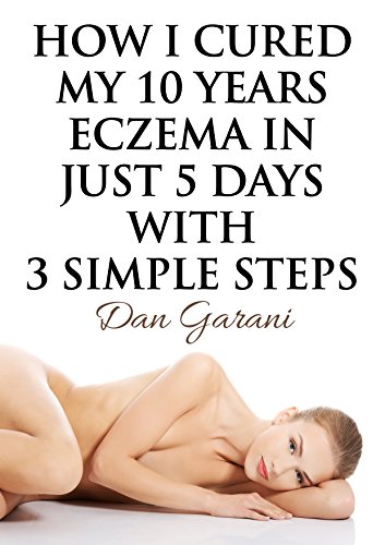 Algopix Similar Product 10 - How I Cured My 10 Years Eczema In Just