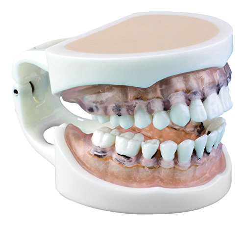 Algopix Similar Product 6 - Practicon 4112174 Bone Furcation Model