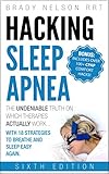 Algopix Similar Product 2 - Hacking Sleep Apnea and CPAP Hacks 
