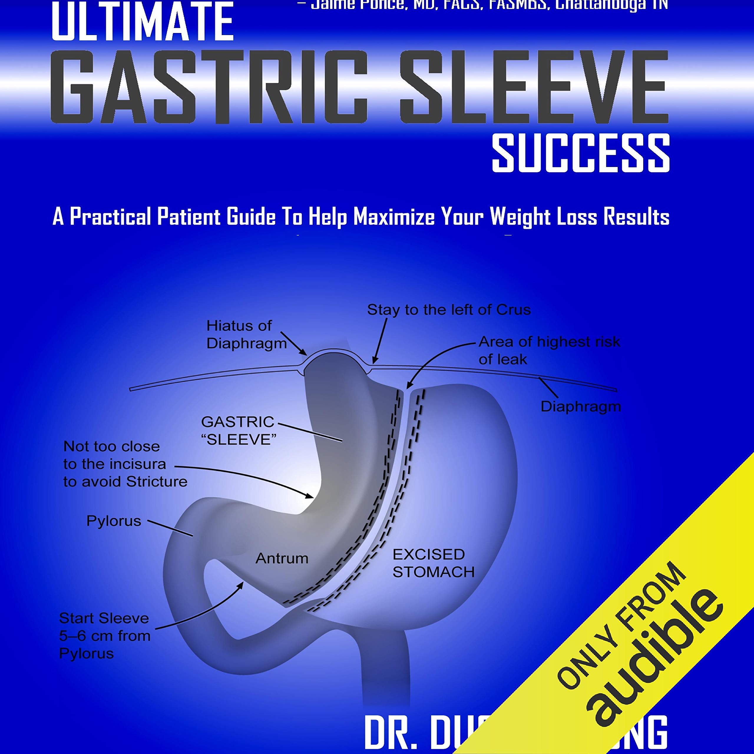 Algopix Similar Product 19 - Ultimate Gastric Sleeve Success A