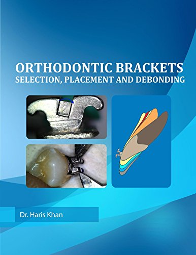 Algopix Similar Product 10 - Orthodontic Brackets