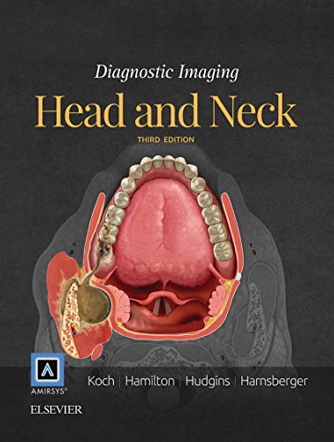 Algopix Similar Product 9 - Diagnostic Imaging: Head and Neck E-Book