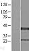 Algopix Similar Product 16 - XRCC3 Overexpression Lysate