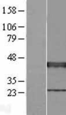 Algopix Similar Product 15 - XRCC3 Overexpression Lysate