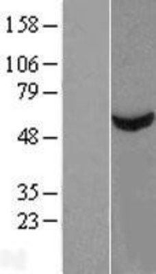 Algopix Similar Product 19 - TBCE Overexpression Lysate