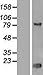 Algopix Similar Product 5 - Thyroid receptorInteracting Protein 13