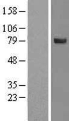 Algopix Similar Product 1 - SPATA20 Overexpression Lysate