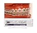 Algopix Similar Product 2 - Comfort Cover Braces GuardLip and