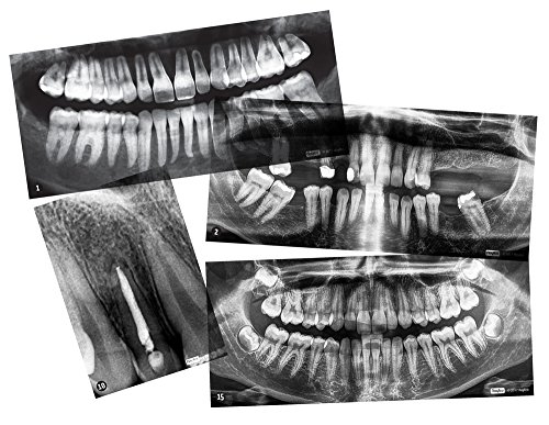 Algopix Similar Product 13 - Dental X-Rays