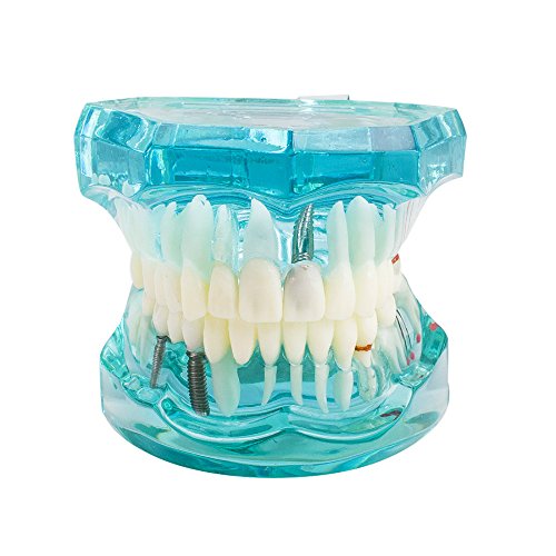Algopix Similar Product 19 - vinmax Dental Teeth ModelTransparent