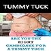Algopix Similar Product 9 - Tummy Tuck Are You the Right Candidate
