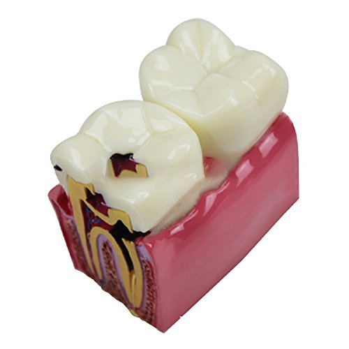 Algopix Similar Product 7 - Pevor New Dental Teeth Model Dental