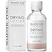 Algopix Similar Product 14 - Majestic Pure Acne Drying Lotion Acne