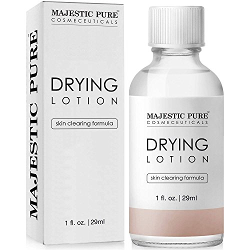Algopix Similar Product 12 - Majestic Pure Acne Drying Lotion Acne