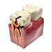 Algopix Similar Product 16 - Dental Caries Tooth Model YOUYA DENTAL