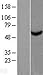 Algopix Similar Product 7 - TBCE Overexpression Lysate