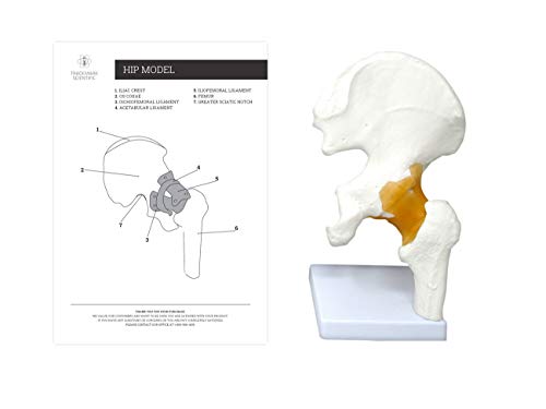 Algopix Similar Product 5 - Hip Joint Anatomical Cast Scientific