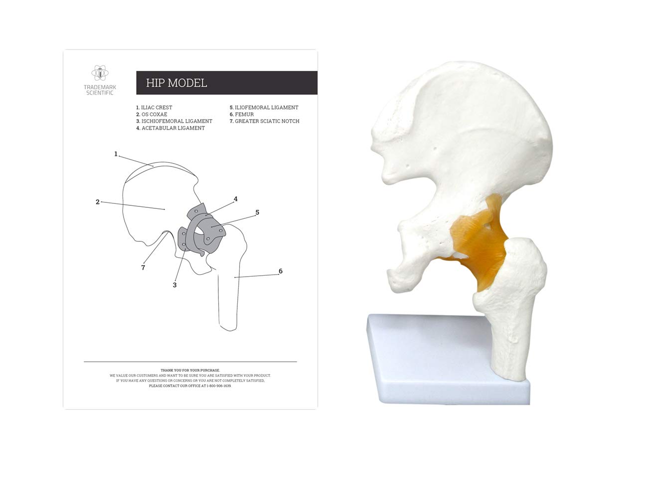 Algopix Similar Product 13 - Hip Joint Anatomical Cast Scientific