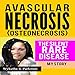 Algopix Similar Product 4 - Avascular Necrosis Osteonecrosis the