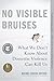 Algopix Similar Product 16 - No Visible Bruises What We Dont Know