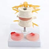 Algopix Similar Product 11 - TwoSection Lumbar Vertebrae Disease