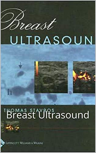 Algopix Similar Product 20 - Breast Ultrasound: Breast Ultrasound