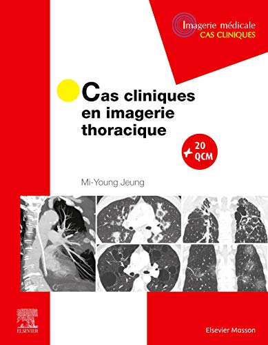Algopix Similar Product 1 - Cas cliniques en imagerie thoracique