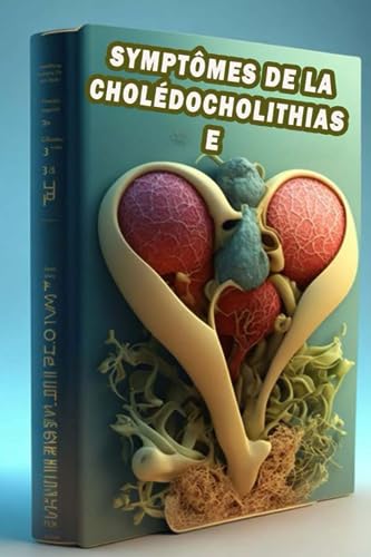 Algopix Similar Product 9 - Symptmes de la choldocholithiase