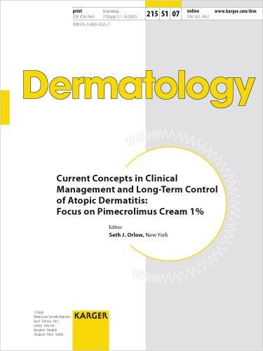 Algopix Similar Product 19 - Current Concepts in Clinical Management