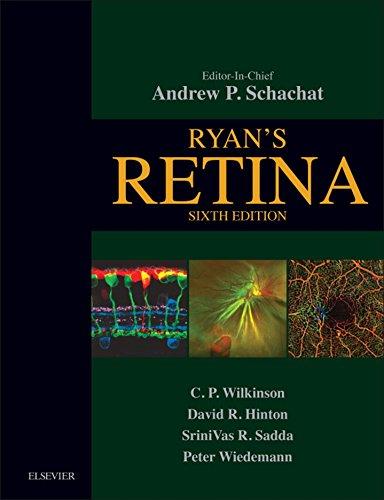 Algopix Similar Product 9 - Ryan's Retina E-Book